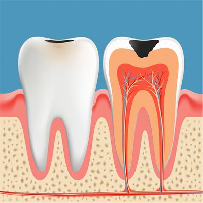 歯の内部構造と歯髄